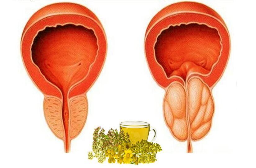 Healthy and wound prostate